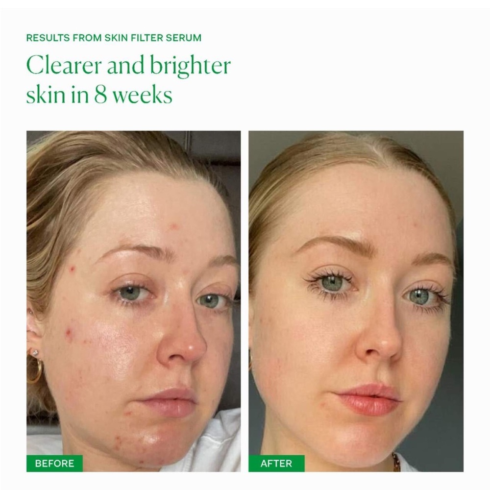 THE NUE CO • SKIN FILTER SERUM - Picture 10 of 12